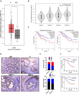 Follistatin-Like 3 Enhances Invasion and Metastasis via β-Catenin-Mediated EMT and Aerobic Glycolysis in Colorectal Cancer